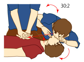 胸骨圧迫と人工呼吸の継続